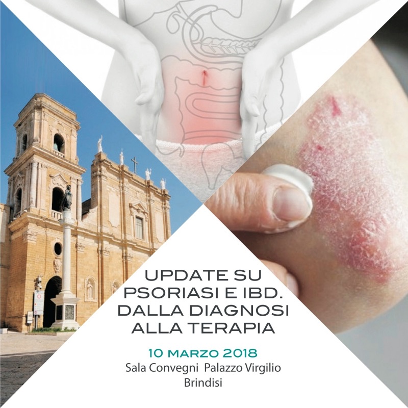 https://www.formedica.it/wp/wp-content/uploads/2018/01/2018.03.10_Brindisi_1.jpg